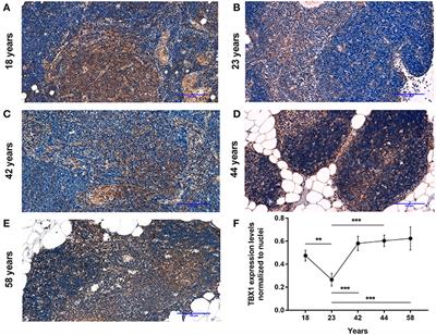 “Beige” Cross Talk Between the Immune System and Metabolism